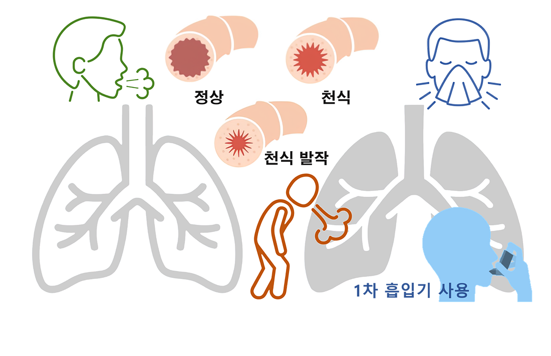 이미지명