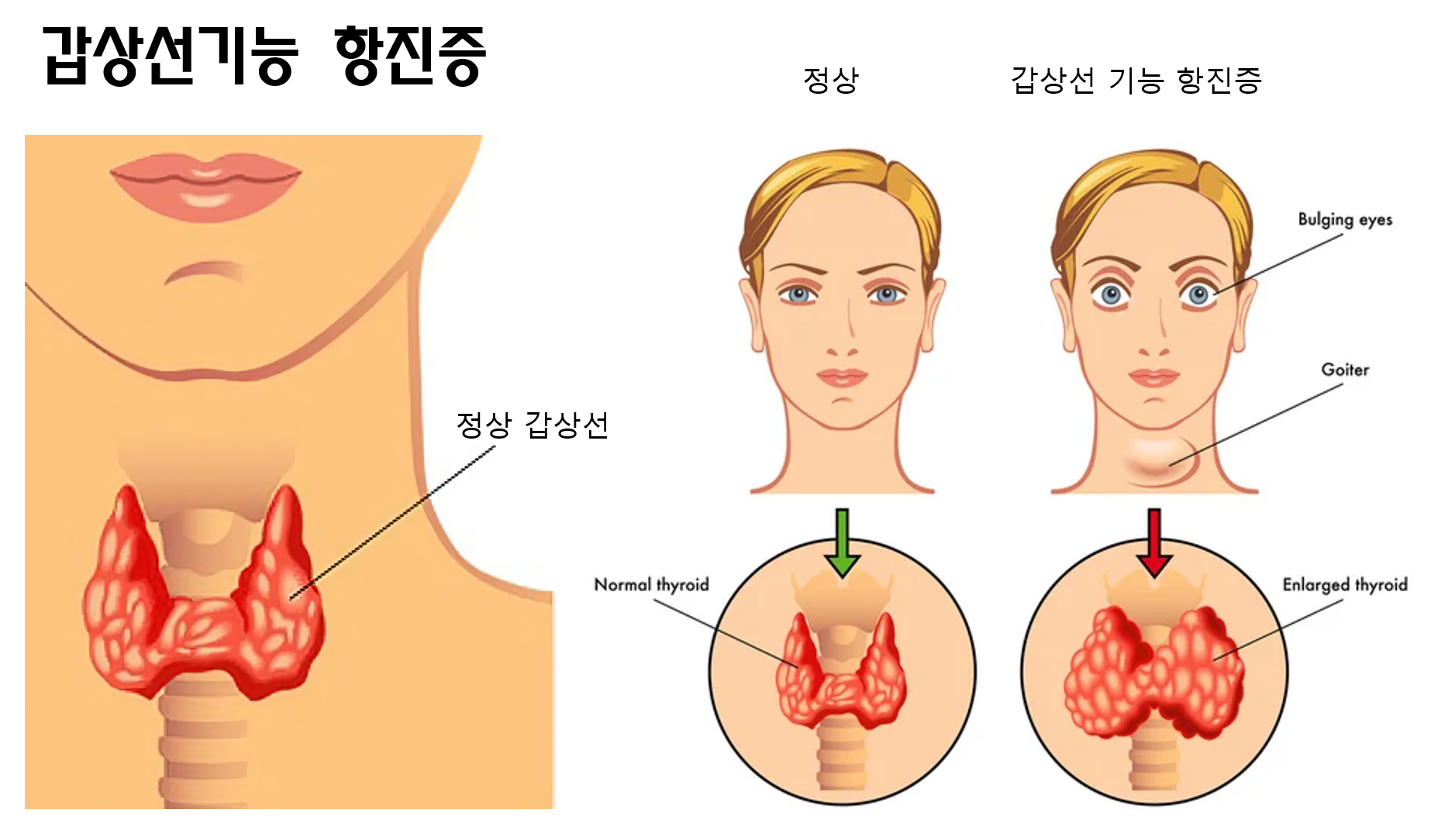 이미지명