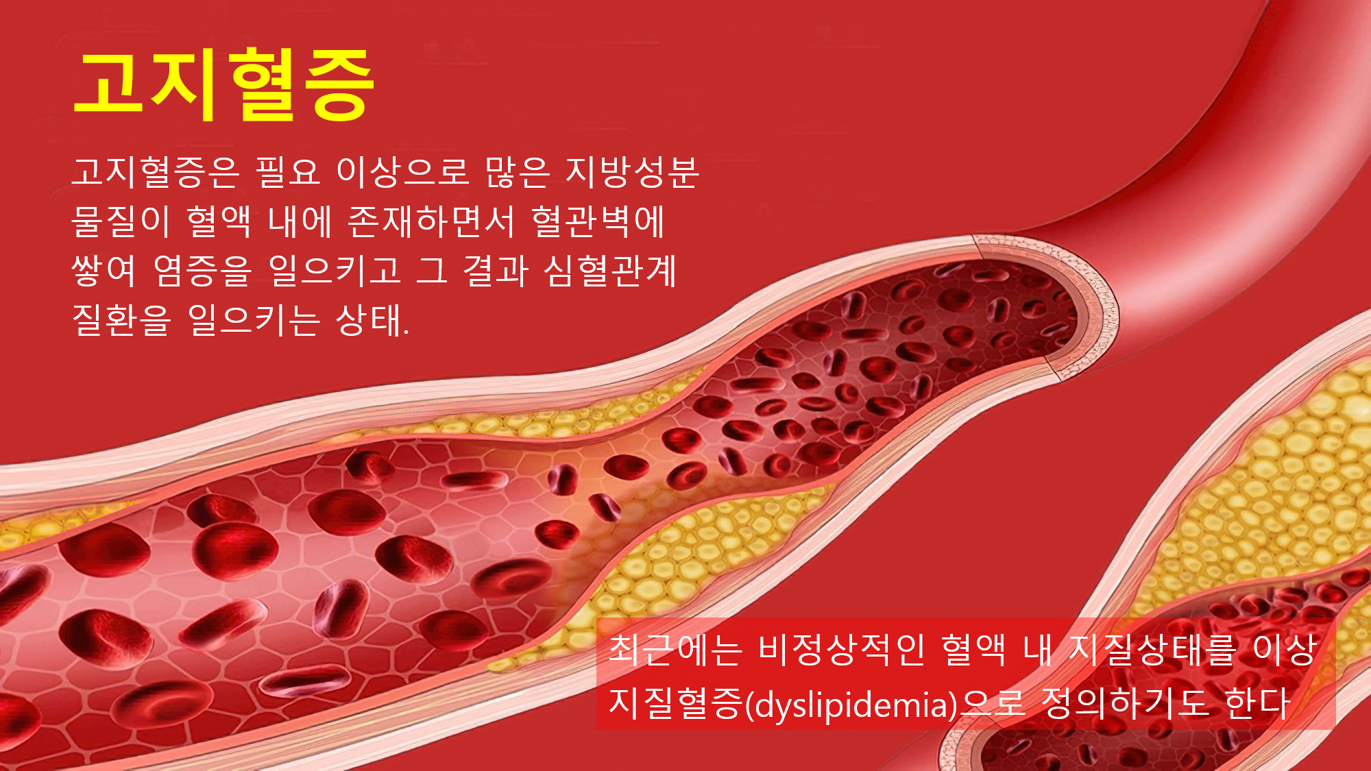 이미지명
