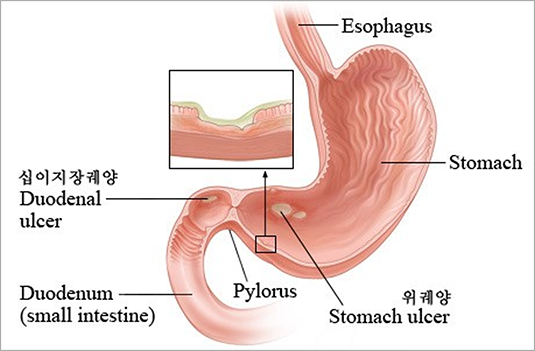 이미지명